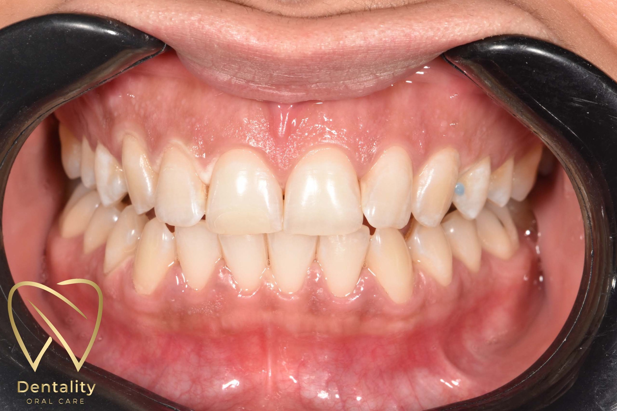Dentality Oral Care Clinic