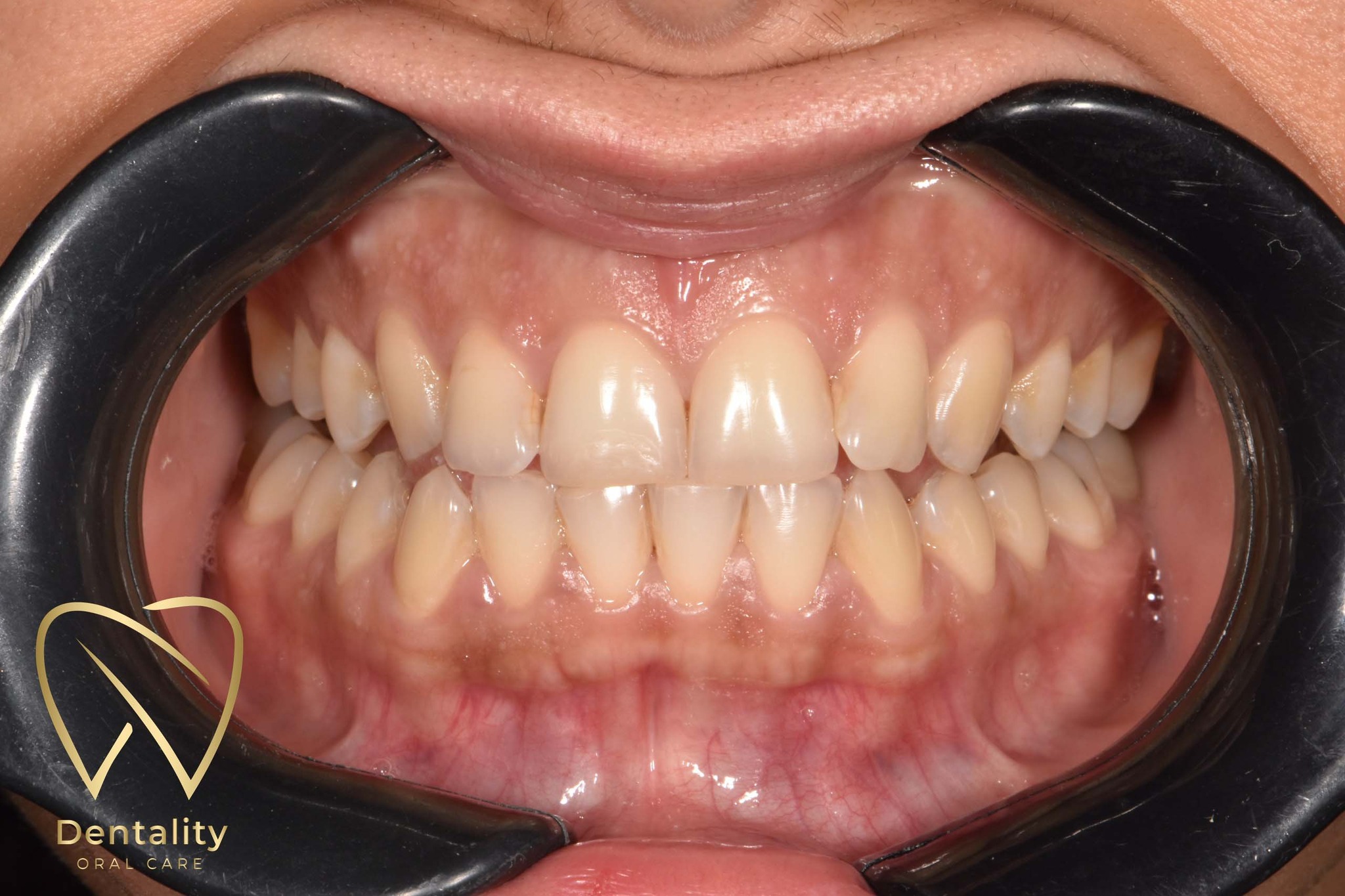 Dentality Oral Care Clinic